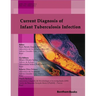 Current Diagnosis of Infant Tuberculosis Infection: , Roberta Olmo Pinheiro,