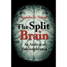 The Split Brain: An Analysis of Schizophrenia