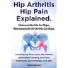 Hip Arthritis, Hip Pain Explained. Osteoarthritis in Hips, Rheumatoid Arthritis in Hips. Including Hip Arthritis Surgery, Hip Flexor Pain, Exercises,