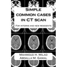 Simple common cases in CT scan: For interns and new residents