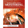 Intra-Operative Monitoring: A Comprehensive Approach