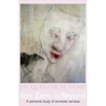 Size Zero and Beyond: A Personal Study of Anorexia Nervosa