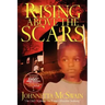 Rising Above the Scars