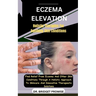 Eczema Elevation: Holistic Therapies For Soothing Skin Conditions: Find Relief From Eczema And Other Skin Conditions Through A Holistic
