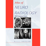 Atlas of Neuroradiology: 200 Common Cases