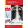 Hemophilia: The Royal Disease