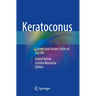 Keratoconus: Current and Future State-Of-The-Art