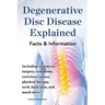 Degenerative Disc Disease Explained. Including Treatment, Surgery, Symptoms, Exercises, Causes, Physical Therapy, Neck, Back, Pain, and Much More! Fac