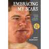 Embracing My Scars: A journey of hope in the face of adversity