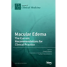 Macular Edema: The Current Recommendations for Clinical Practice