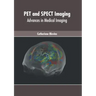 Pet and Spect Imaging: Advances in Medical Imaging