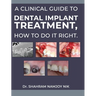 A clinical guide to dental implant treatment, how to do it right.