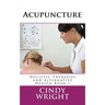 Acupuncture