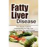 Fatty Liver Disease: The Ultimate Guide for Understanding the Fatty Liver Diet And What You Need to Know