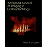 Advanced Aspects of Imaging in Oral Implantology