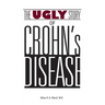 The Ugly Story of Crohn's Disease
