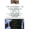 Phantoms in the Brain
