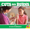 Cuts and Burns