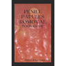 Penile Papules Romoval Book Guide: The Ultimate Guide On How To Remove Pearly Penile Papules Using Natural Remedies