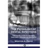 The Pathology of Dental Infections: and Its Relation to General Diseases - History of Dentistry