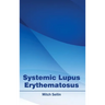Systemic Lupus Erythematosus