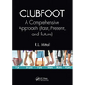 Clubfoot: A Comprehensive Approach (Past, Present, and Future)