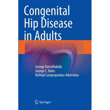 Congenital Hip Disease in Adults