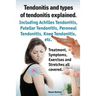Tendonitis and the Different Types of Tendonitis Explained. Tendonitis Symptoms, Diagnosis, Treatment Options, Stretches and Exercises All Included.