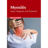 Myositis: Types, Diagnosis and Treatment