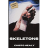 Skeletons: Extended Edition
