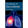 Handbook of Sarcoidosis
