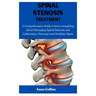 Spinal Stenosis Treatment: A Comprehensive Guide to learn everything about Managing Spinal Stenosis and Cultivating a Stronger and Healthier Spin