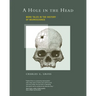A Hole in the Head: More Tales in the History of Neuroscience